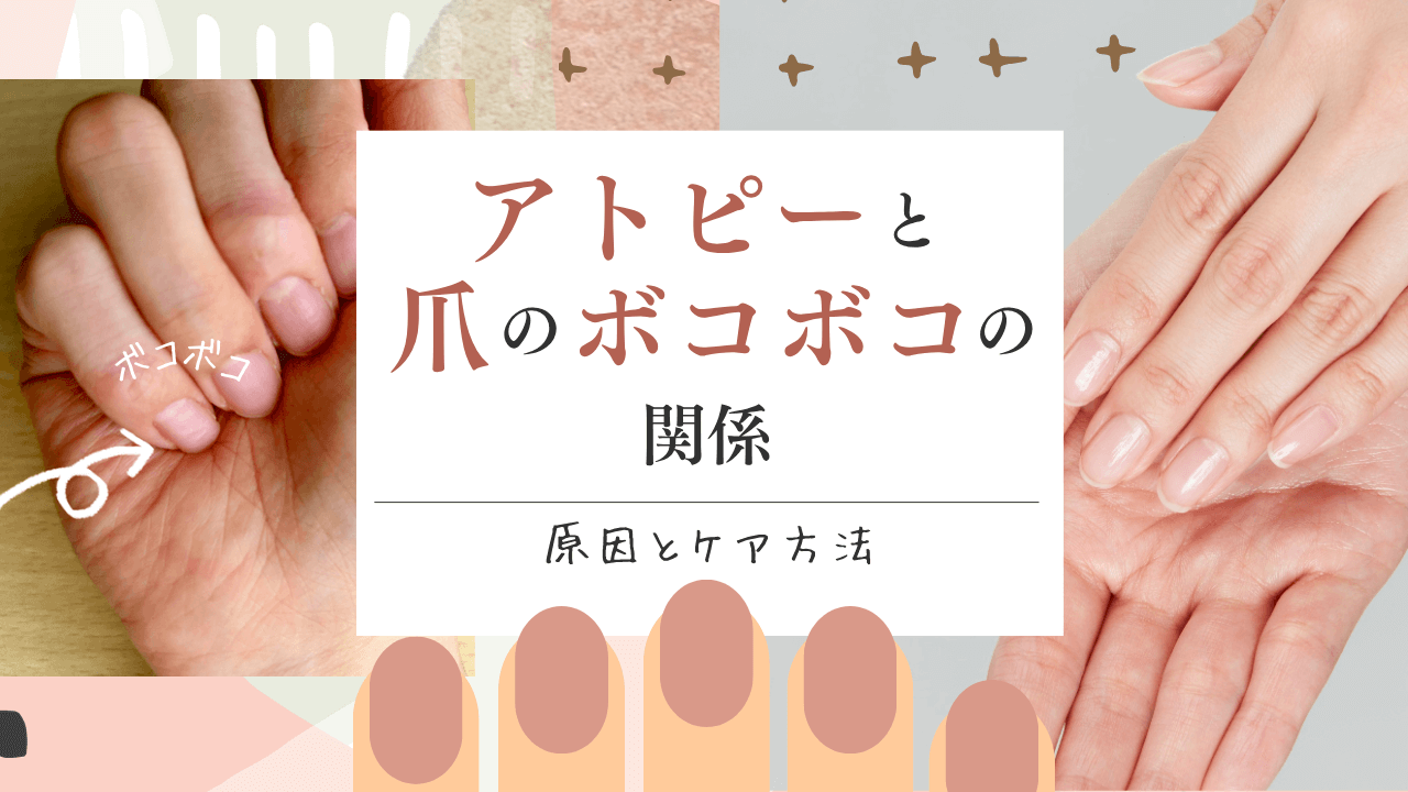 アトピーと爪のボコボコの関係｜原因とケア方法