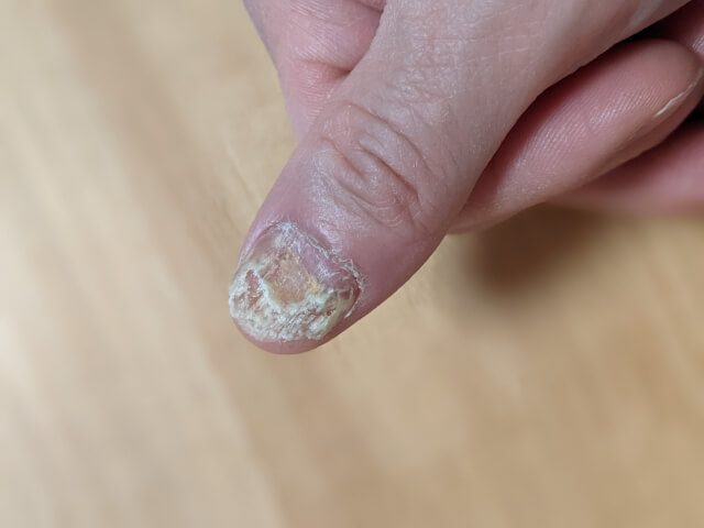 爪水虫